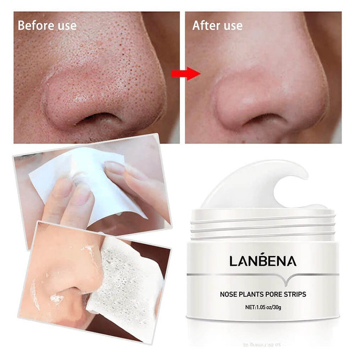 LANBENA - Gesichtsmaske gegen Mitesser
