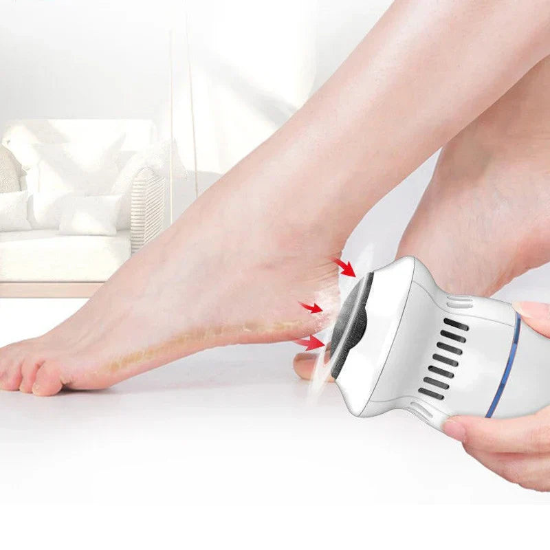 Elektrischer Profi-Hornhautentferner im Einsatz für sanfte Fußpflege, ergonomisches Design für glatte, samtweiche Füße.