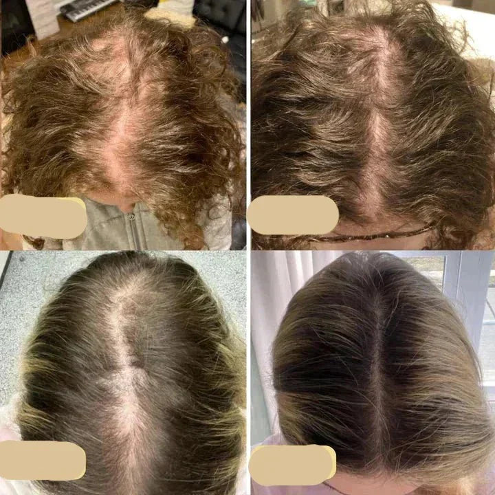 "Veganes Haarwuchsöl gegen Haarausfall, mit Grünkaffee und Arganöl, in einer eleganten Glasflasche vor weißem Hintergrund."