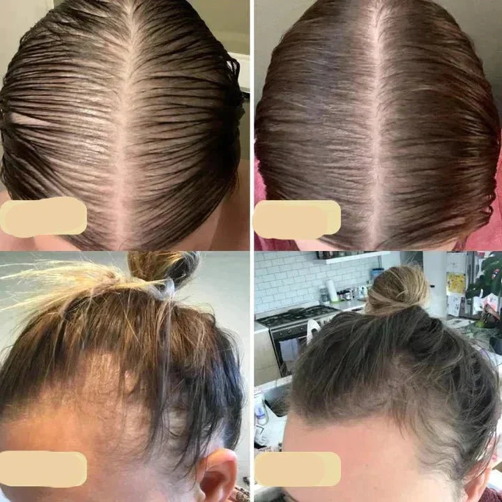 "Veganes Haarwuchsöl gegen Haarausfall, mit Grünkaffee und Arganöl, in einer eleganten Glasflasche vor weißem Hintergrund."