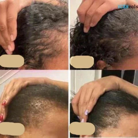 "Veganes Haarwuchsöl gegen Haarausfall, mit Grünkaffee und Arganöl, in einer eleganten Glasflasche vor weißem Hintergrund."